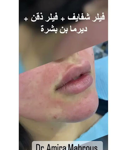 Lamer Clinics - Riyadh - +966 55 583 5664