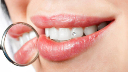 مجمع عيادات بن عنكيص لطب الاسنان - Najran - +966 17 522 2197